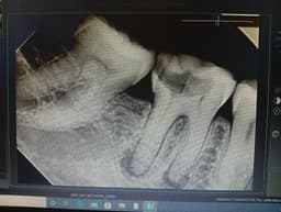Radiograph